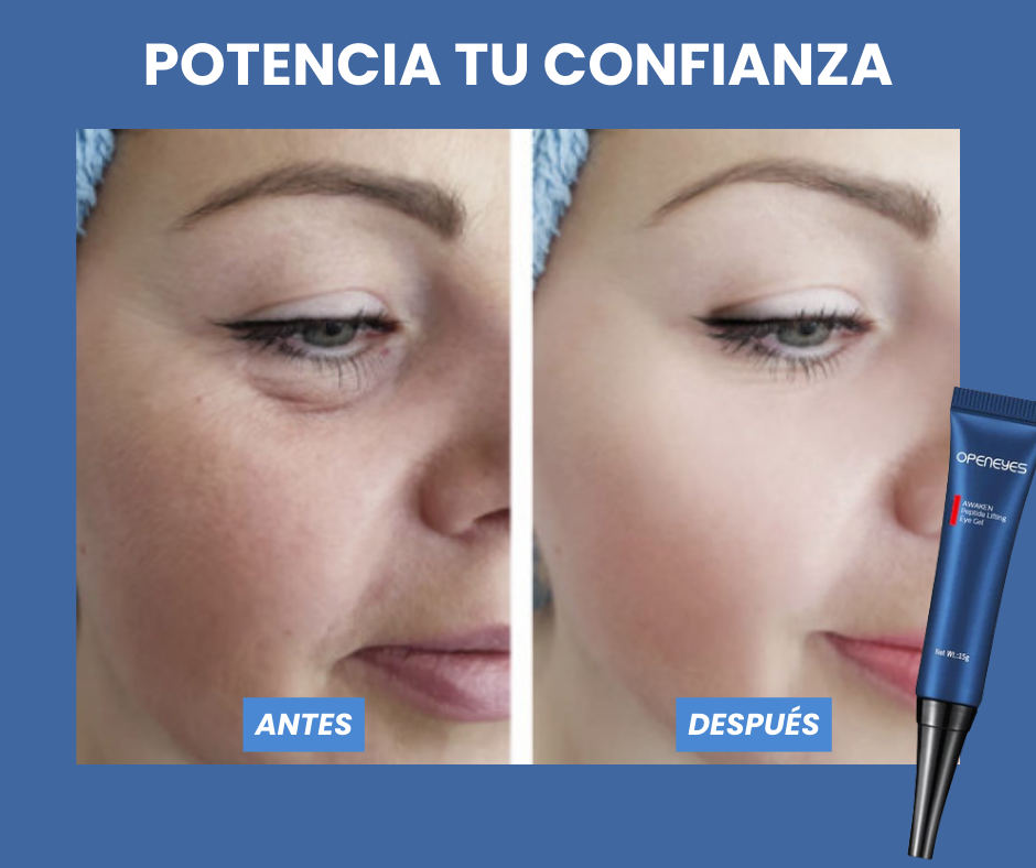 Elimina las ojeras y bolsas de tus ojos - OpenEye™ | 1+1 GRATIS 🎁