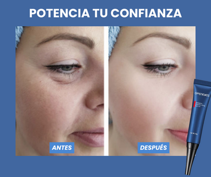 Elimina las ojeras y bolsas de tus ojos - OpenEye™ | 1+1 GRATIS 🎁