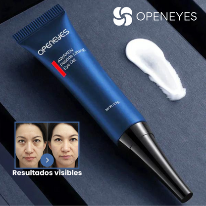 Elimina las ojeras y bolsas de tus ojos - OpenEye™ | 1+1 GRATIS 🎁