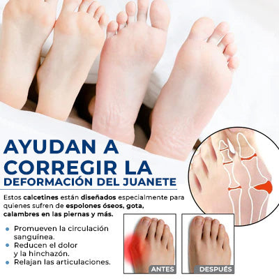 Calcetines Ortopédicos para aliviar juanete - CC™